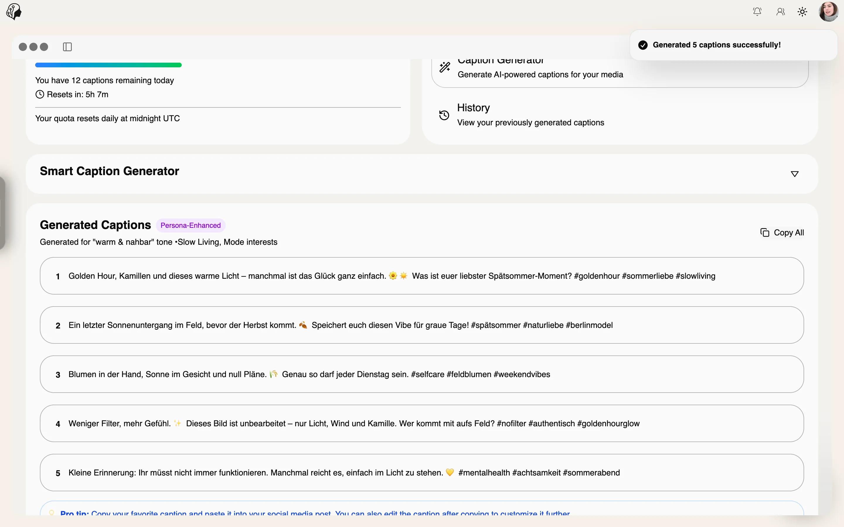 ModelSuite – Captions im Model-Portal